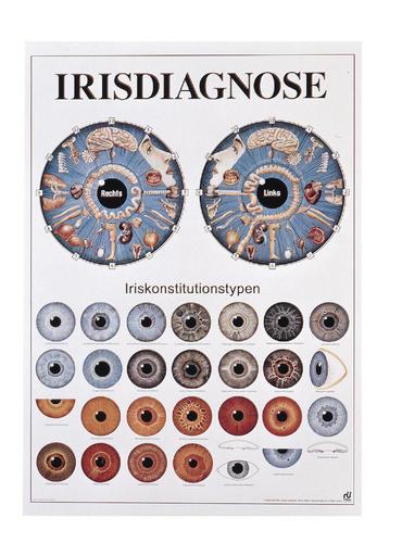 RUEDIGER Poster 50x70 Iris-Diagnose