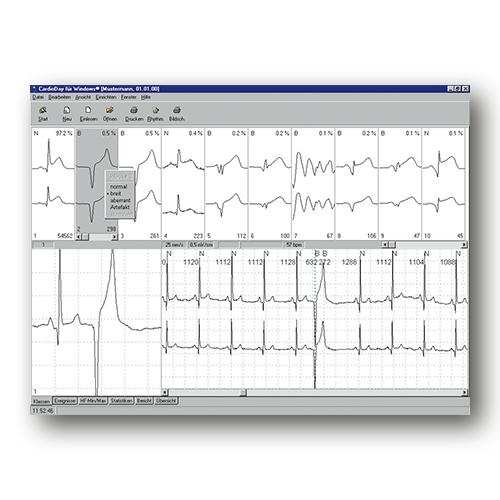 Seer1000-Kabel, 5polig, 2Kanal, 61cm IEC