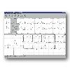 CardioDay EASY V2.6 SEER 1000 48h