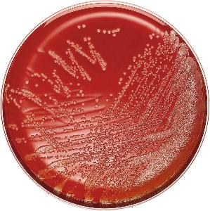 Columbia Agar 5% Schafblut Petrischalen, 20Stk