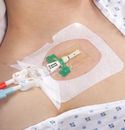 Tegaderm IV Kanülenpflaster 8,5x11,5cm