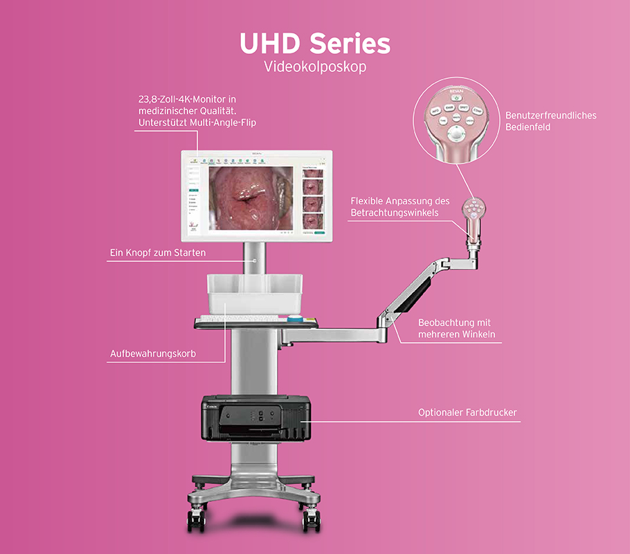 UHD Series Videokolposkop; 23,8-Zoll-4K-Monitor in medizinischer Qualität. Unterstützt Multi-Angle-Flip; Ein Knopf zum Starten; Aufbewahrungskorb; Benutzerfreundliches Bedienfeld; Flexible Anpassung des Betrachtungswinkels; Beobachtung mit mehreren Winkeln; Optimaler Farbdrucker;