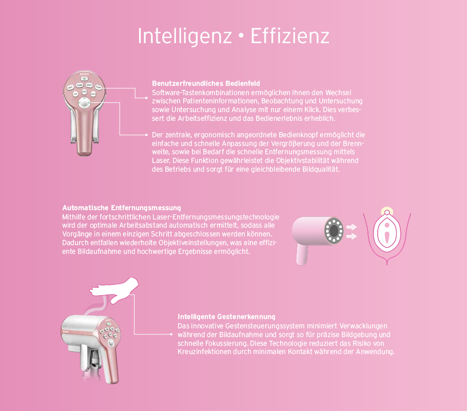 Benutzerfreundliches Bedienfeld - Software-Tastenkombinationen ermöglichen Ihnen den Wechsel zwischen Patienteninformationen, Beobachtung und Untersuchung sowie Untersuchung und Analyse mit nur einem Klick. Dies verbessert die Arbeitseffizienz und das Bedienerlebnis erheblich. Der leistungsstarke „All-in-One“-Azimutschlüssel bietet eine feinfühlige Steuerung von Vergrößerung und Brennweite und ermöglicht eine präzise Laser-Entfernungsmessung mit nur einem Klick. Diese Funktion gewährleistet die Objektivstabilität während des Betriebs und sorgt für eine gleichbleibende Bildqualität.; Automatische Entfernungsmessung - Mithilfe der fortschrittlichen Laser-Entfernungsmessungstechnologie wird der optimale Arbeitsabstand automatisch ermittelt, sodass alle Vorgänge in einem einzigen Schritt abgeschlossen werden können. Dadurch entfallen wiederholte Objektiveinstellungen, was eine effiziente Bildaufnahme und hochwertige Ergebnisse ermöglicht.; Intelligente Gestenerkennung - Das innovative Gestensteuerungssystem minimiert Verwacklungen während der Bildaufnahme und sorgt so für präzise Bildgebung und schnelle Fokussierung. Diese Technologie reduziert das Risiko von Kreuzinfektionen durch minimalen Kontakt während derAnwendung.