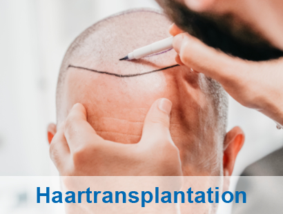 Henry Schein MED | Ästhetik - Haartransplantation